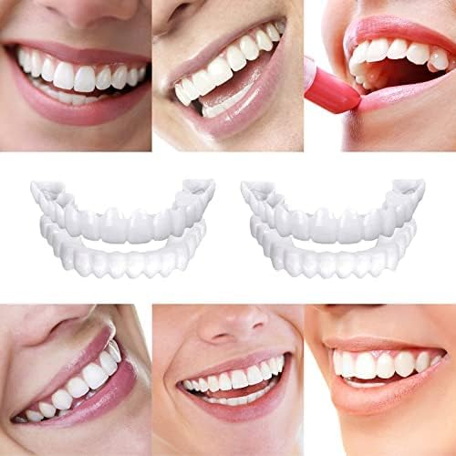 Snap-on Smile For Beautiful Smiles