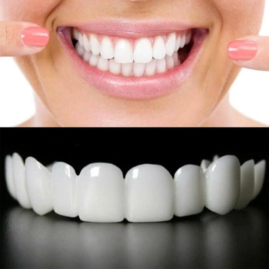 Snap-on Smile: Instant Confidence with a Brighter, Whiter Smile – Free Delivery!